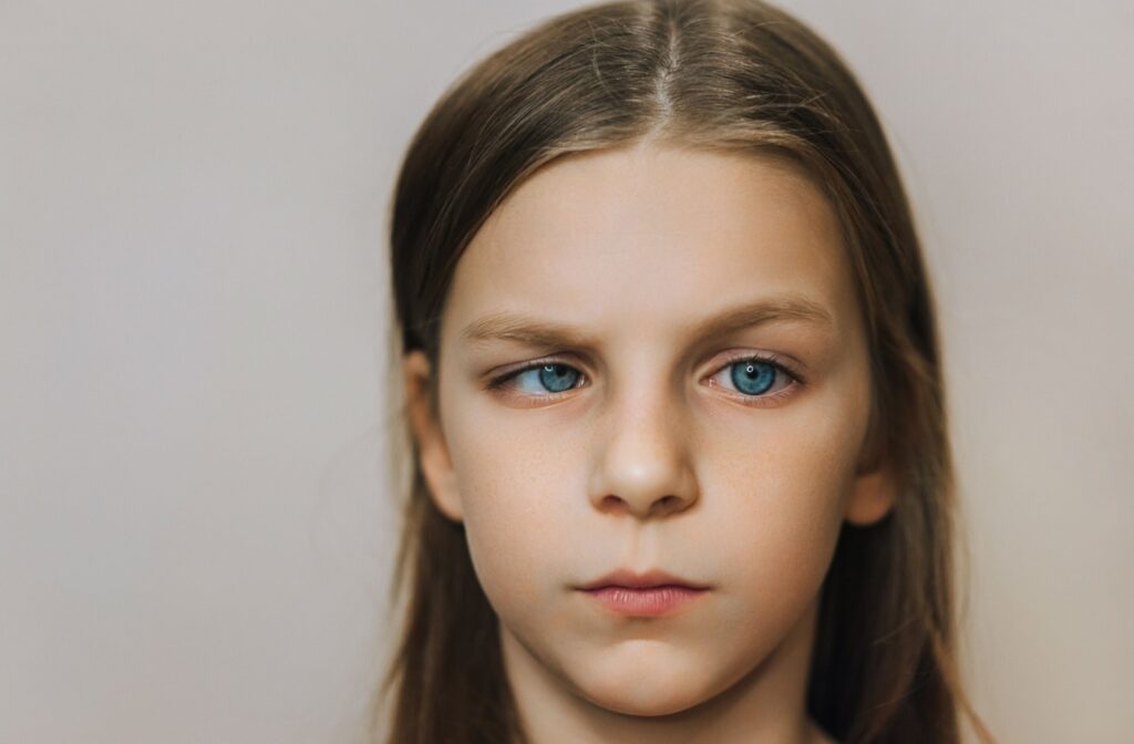 A child with blue eyes showing signs of strabismus, where one eye is misaligned and turning inward, a condition affecting eye alignment and coordination.